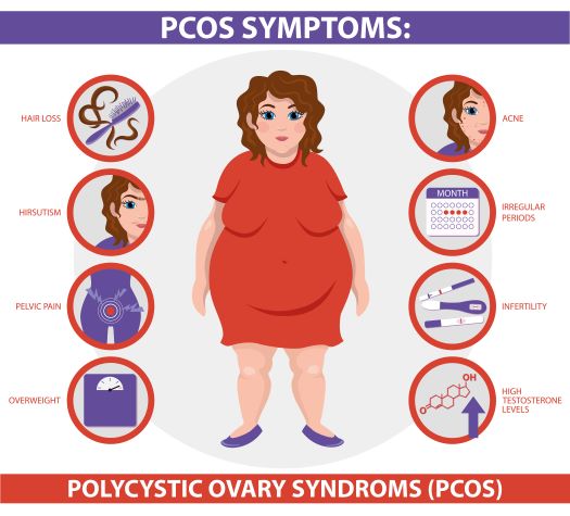 Ayurvedic treatments for PCOS – Poly cystic ovarian syndrome or disease